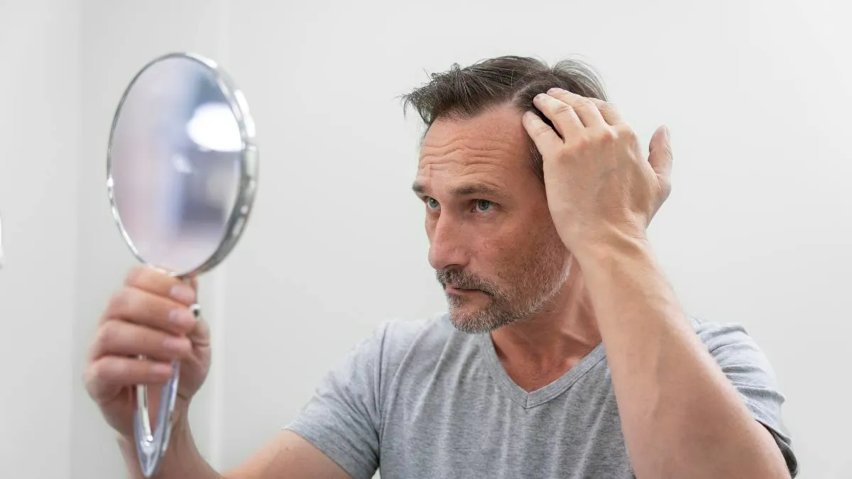 Hair Transplant Cost in Dubai