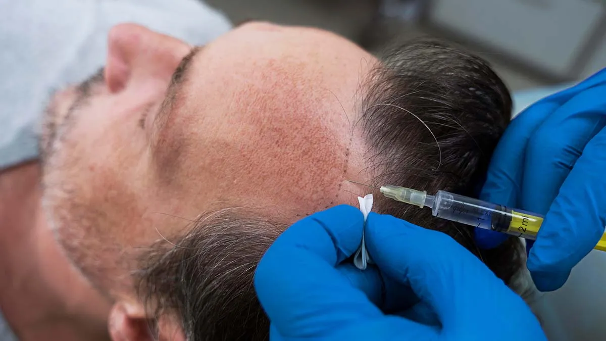 Hair Loss Treatment